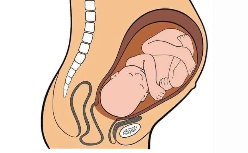 هل يرتفع الجنين بعد نزوله الحوض